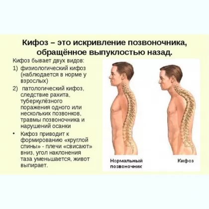 ПРОФЕССИОНАЛЬНЫЙ МАССАЖ СПИНЫ НА ДОМУ НЕ САЛОН ДЛЯ ВОДИТЕЛЯ